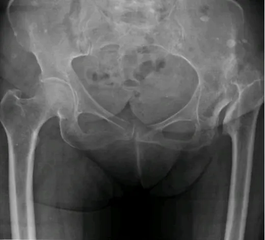 Caso 1 - imagen principal