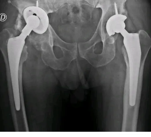 Caso 2 - imagen principal