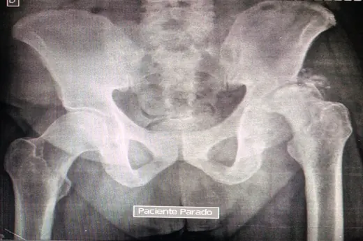 Caso 3 - imagen principal